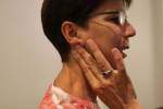 TMJ Muscle Pain - Clayton A. Chan, DDS 4